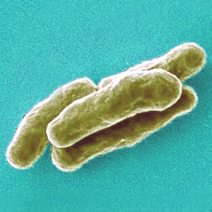 Mycobacterium tuberculosis1.jpg